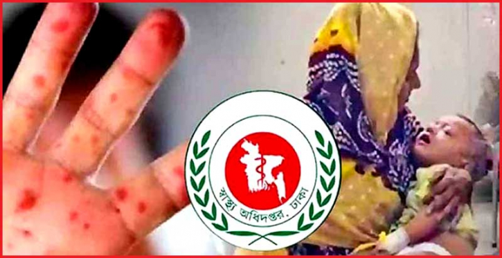 হামের উপসর্গ নিয়ে আরও ৪ শিশুর প্রাণহানি