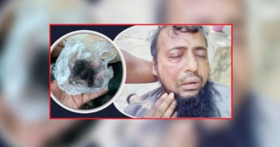 ফেনীতে জামায়াত কর্মীকে পিটিয়ে দাড়ি উপড়ে ফেললেন বিএনপি কর্মীরা