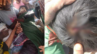 সীমান্তের ওপার থেকে আসা গুলিতে বাংলাদেশি ২ কিশোর আহত