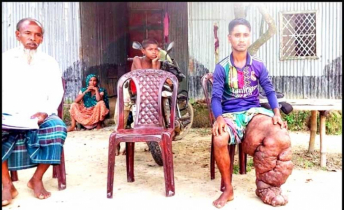 আবু বক্কর ১৭ বছর পায়ের ভারে বন্দি,অর্থাভাবে থমকে আছে চিকিৎসা